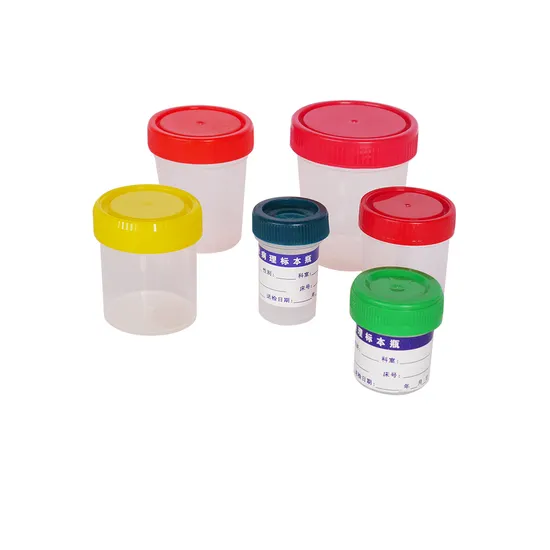 उच्च गुणवत्ता वाले OEM ODM प्रयोगशाला साधन मूल्य हेमटोलॉजी विश्लेषक पेट्री डिश नमूना कंटेनर
